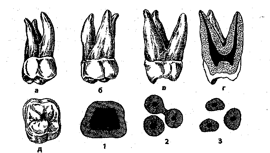 Моляры коренные зубы. Третий моляр верхней челюсти анатомия. 26 Моляр верхней челюсти. Зуб моляр верхний с корнем. Анатомия 6 моляра верхней челюсти.